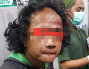 Terjatuh Saat Bawa Motor Hasil Curian, Pelaku Ditangkap Polsek Rangkasbitung