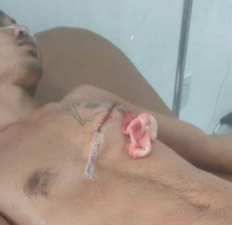 Pemuda Pancasila Bacok Anggota FKPPI